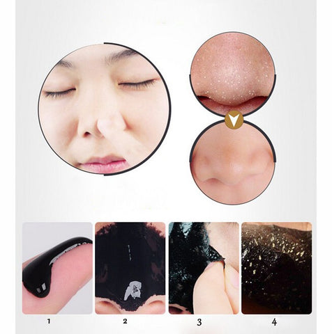 Blackhead Remover